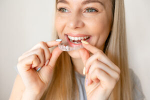 A Clear Choice for Straight Teeth: Understanding Invisalign Braces