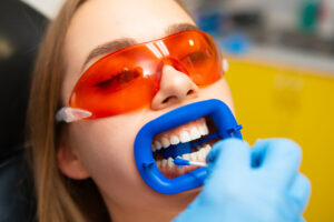 Shedding Light on Teeth Whitening: A Complete Guide